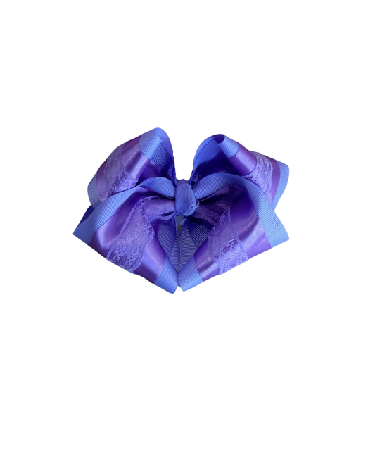 5" Lace Bow